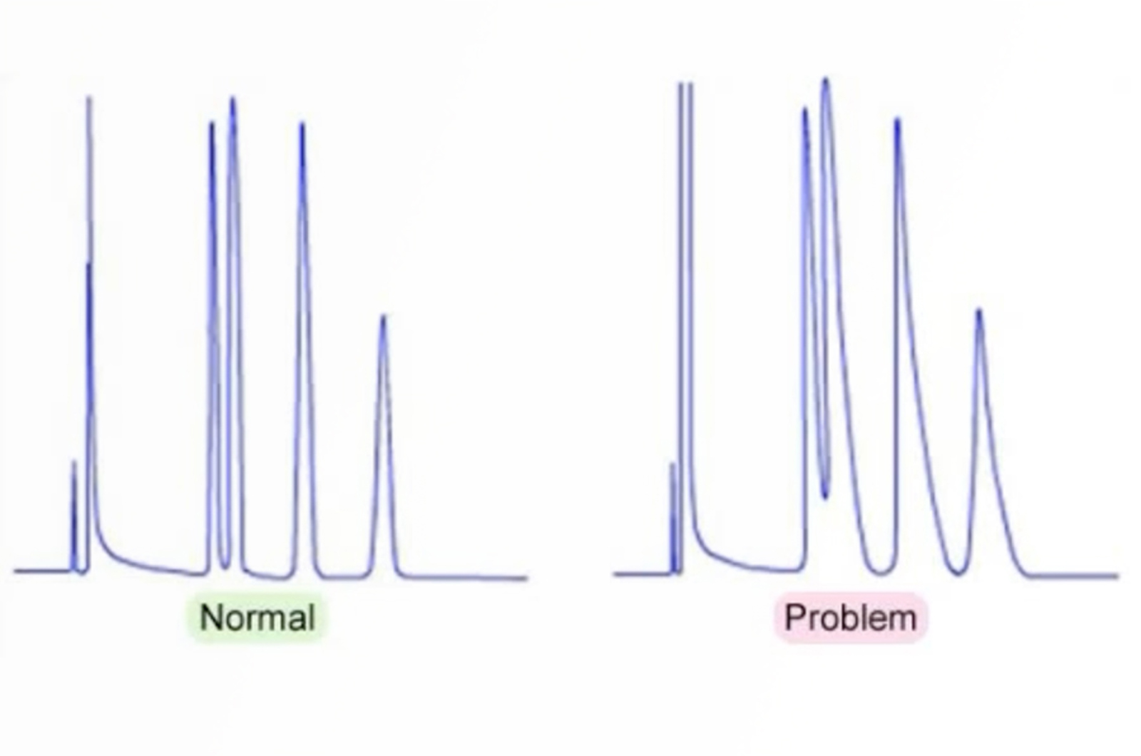 Practical GC Troubleshooting Video - Peak Tailing